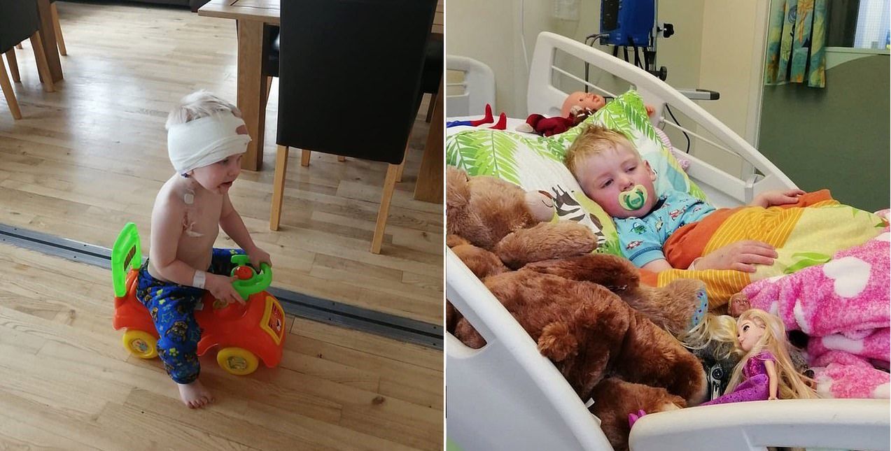 Rozlany glejak pnia mózgu rozwija się w ukryciu. Dziwny uśmiech u dziecka był objawem śmiertelnej choroby