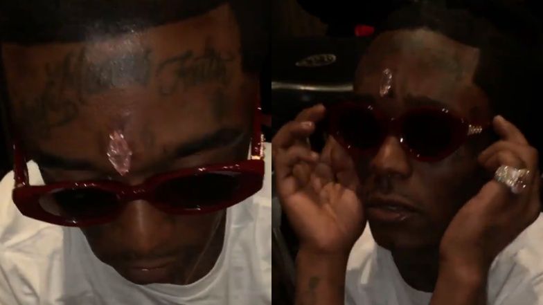 Lil Uzi Vert wszczepił sobie diament w czoło. Klasa?