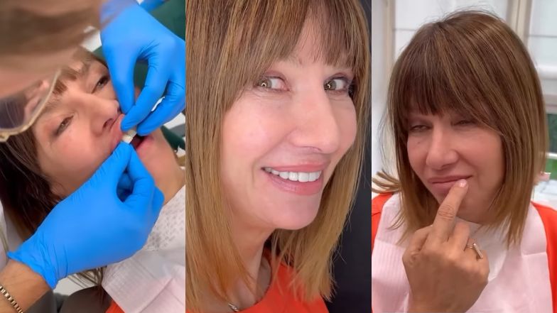 Grażyna Wolszczak chwali się licówkami