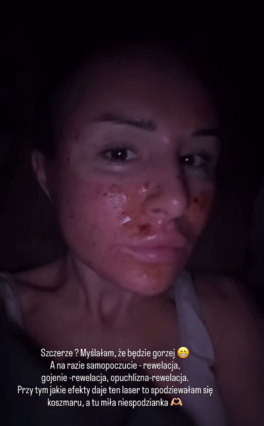 Blanka Lipińska 