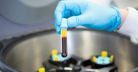 Prosty test z krwi pomoże określić rodzaj nowotworu. Przełom w badaniach