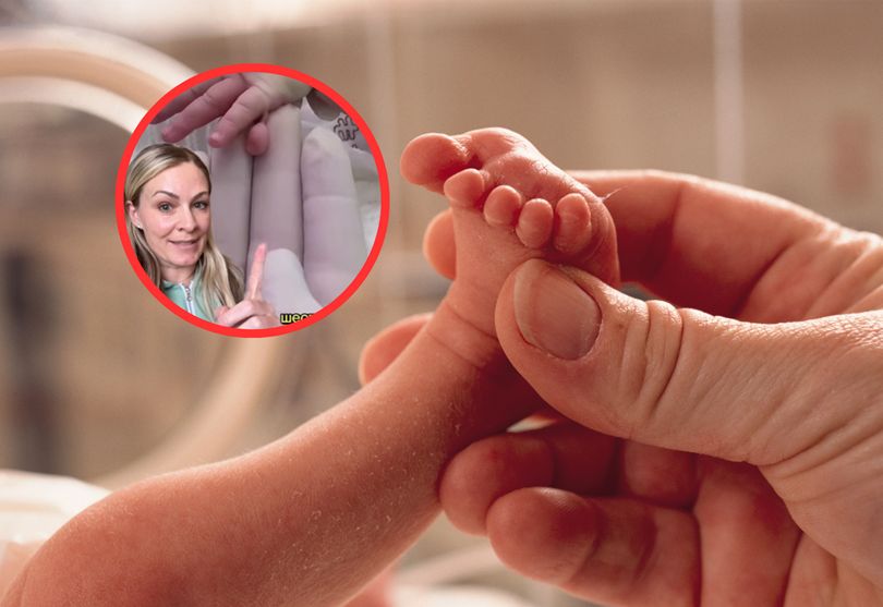 Ekspertka ostrzega. To popularna wada wrodzona