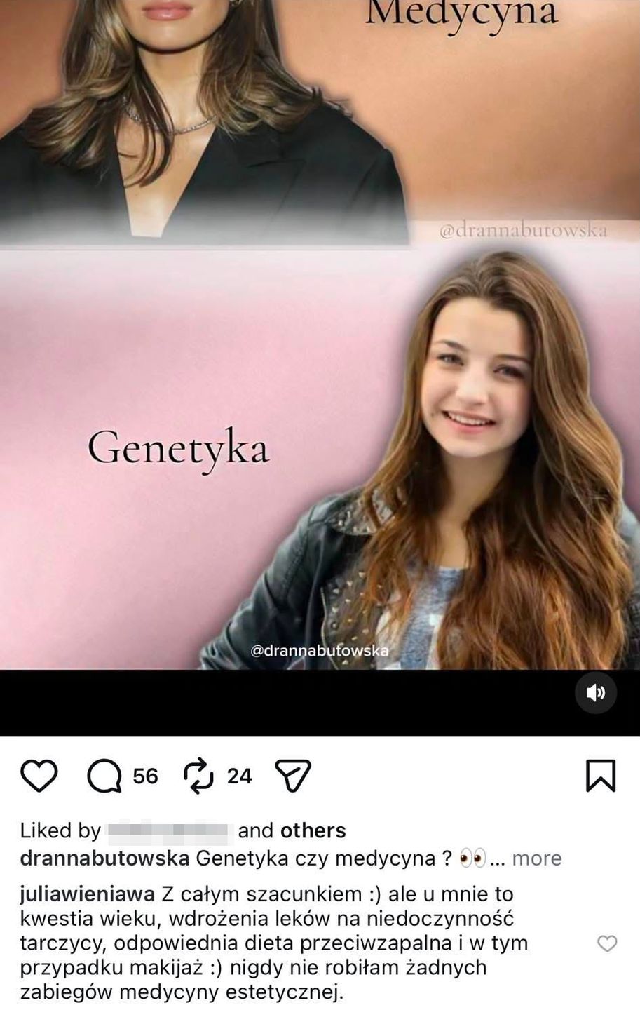 Julia Wieniawa dementuje, że majstrowała przy twarzy