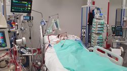 Leczenie COVID-19. Historie pacjentów, którzy byli podłączeni do ECMO