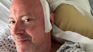 Zaczęło się od zawrotów głowy podczas spaceru. Tak objawiał się agresywny nowotwór