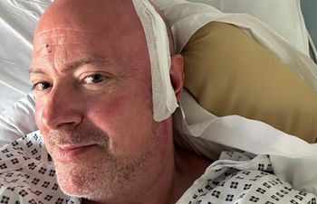 Zaczęło się od zawrotów głowy podczas spaceru. Tak objawiał się agresywny nowotwór
