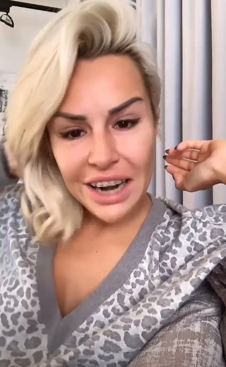 Blanka Lipińska zdjęła aparat i podcięła dziąsła