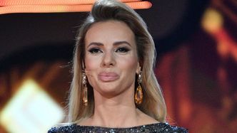Usta Izabeli Janachowskiej wywołały burzę wśród internautów: "Coś się ZEPSUŁO w tak pięknej urodzie"