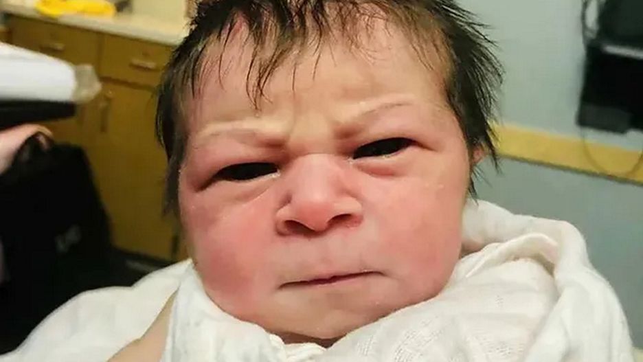 Była w szoku, gdy pierwszy raz zobaczyła syna. "Mam nadzieję, że jego twarz się zmieni".