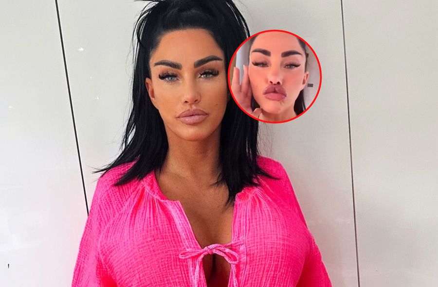 Katie Price po operacjach