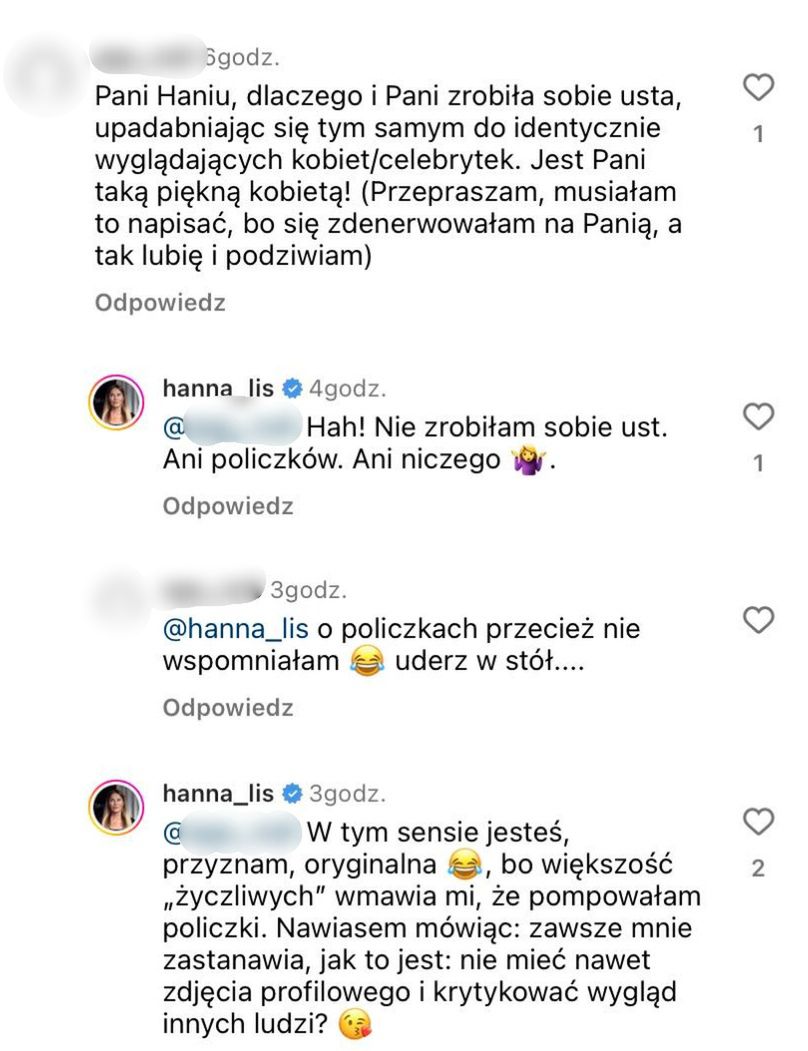Internautka posądziła Hannę Lis o powiększanie ust. Doczekała się odpowiedzi