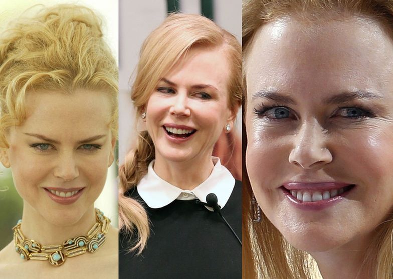 Nicole Kidman