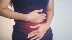 Pylorostenoza - przyczyny, objawy, leczenie