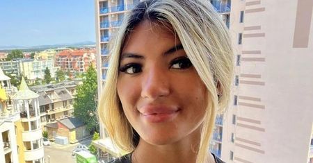 Zasnęła na słońcu. Gdy spojrzała w lustro, nie mogła uwierzyć