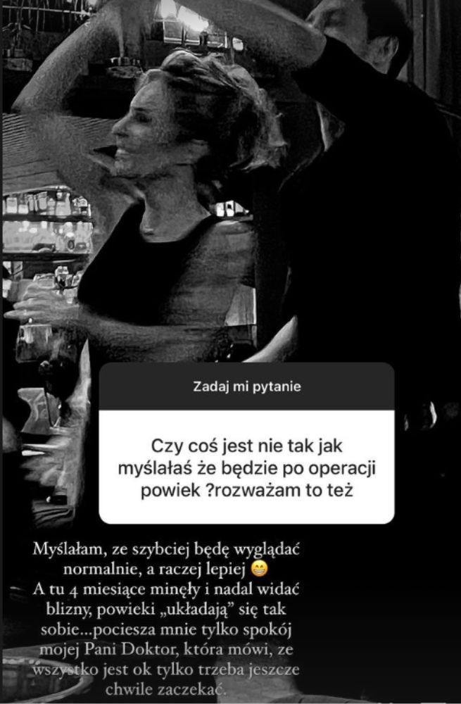 Blanka Lipińska o operacji powiek 