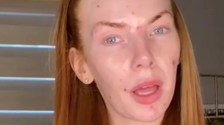 From acne breakouts to stunning makeovers: how TikTok's Jessy Volk mesmerizes with makeup transformations