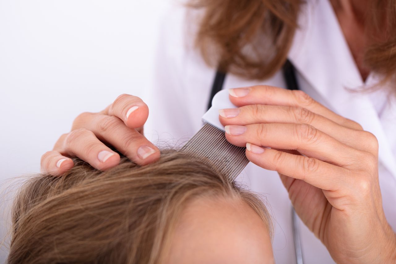 Busting lice myths: Understanding causes and effective solutions