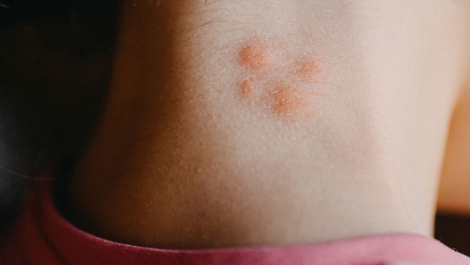 Meszki i komary można odstraszać domowymi sposobami