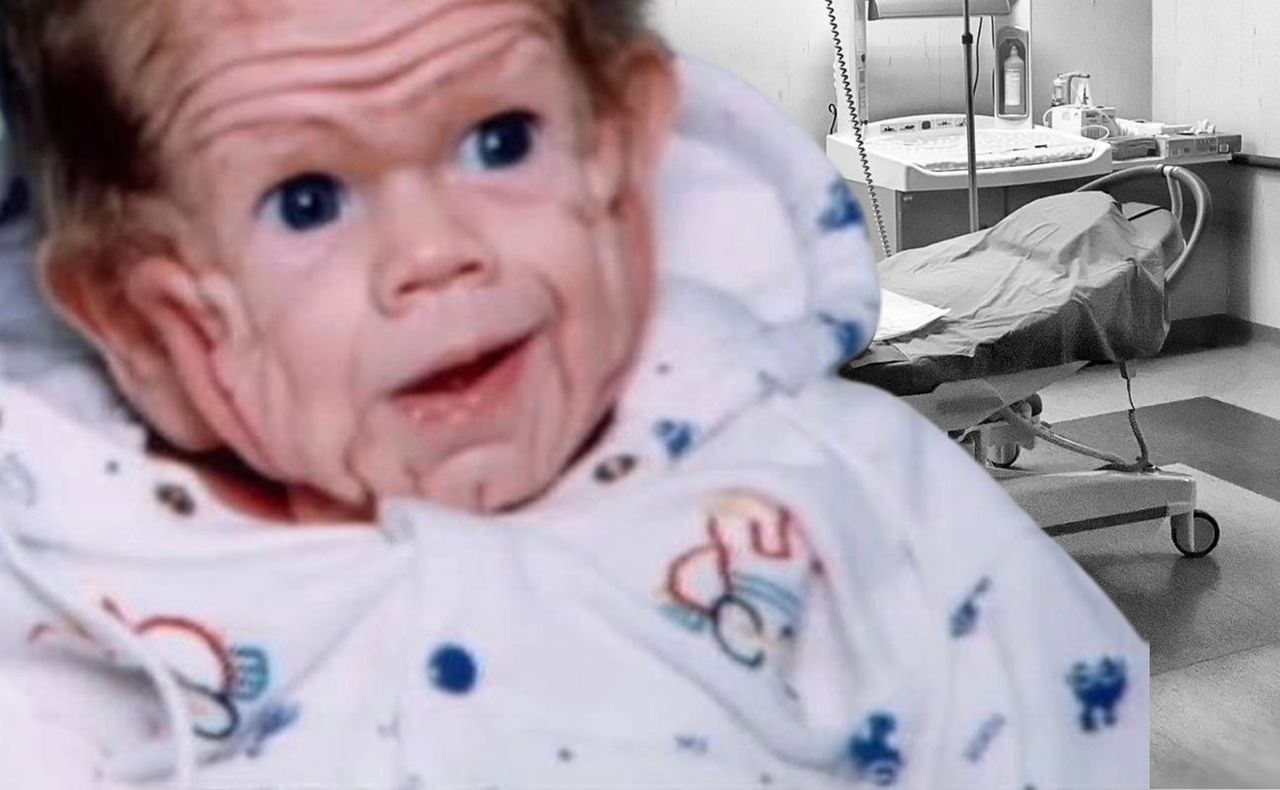 Gdy się urodził, miał twarz jak staruszek