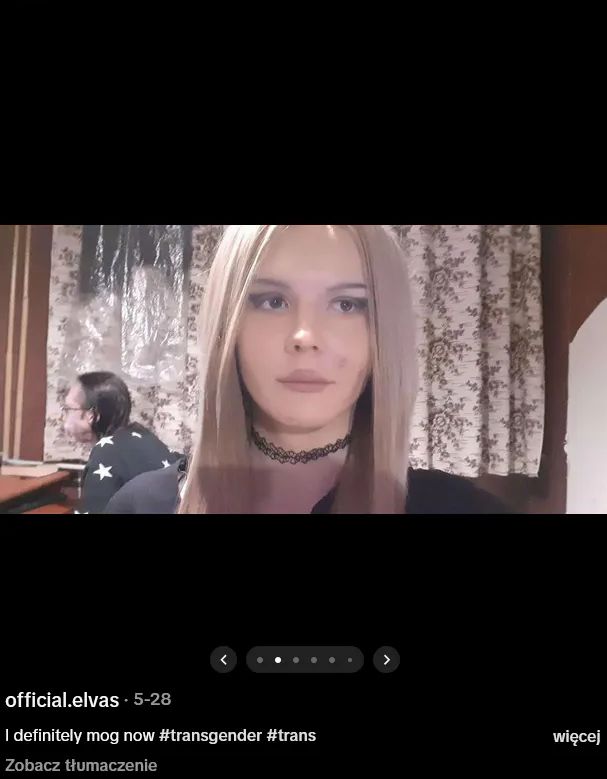 Elva przed zastrzykami z silikonu