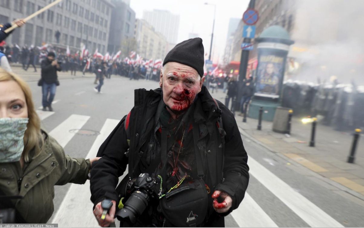 O 2 w nocy przyszła policja. Relacja postrzelonego fotoreportera