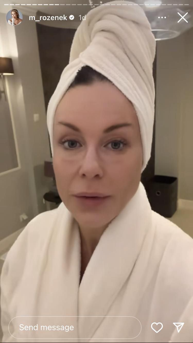 Małgorzata Rozenek pokazuje siniaki po porannym basenie