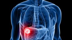 Nawyki dobre dla wątroby. Chronią przed marskością i rakiem