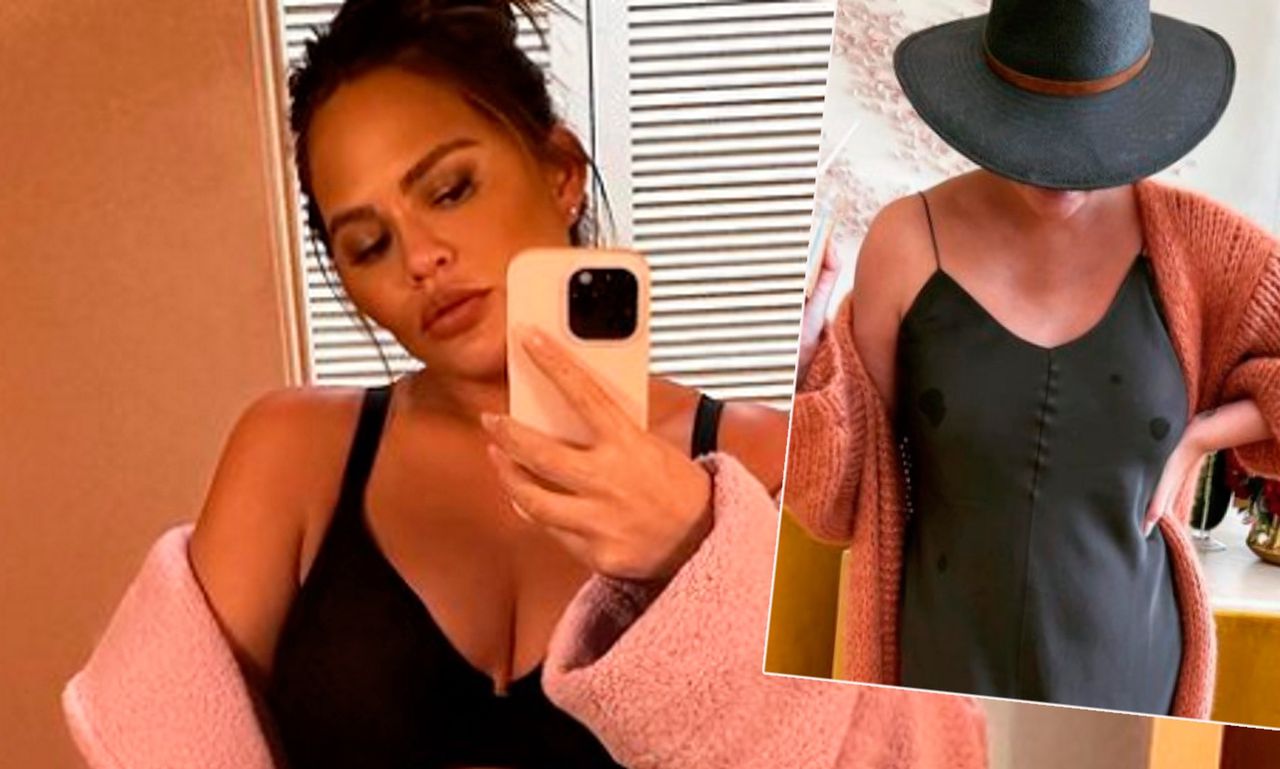 Chrissy Teigen dopiero co została mamą. Pokazuje całą prawdę o połogu