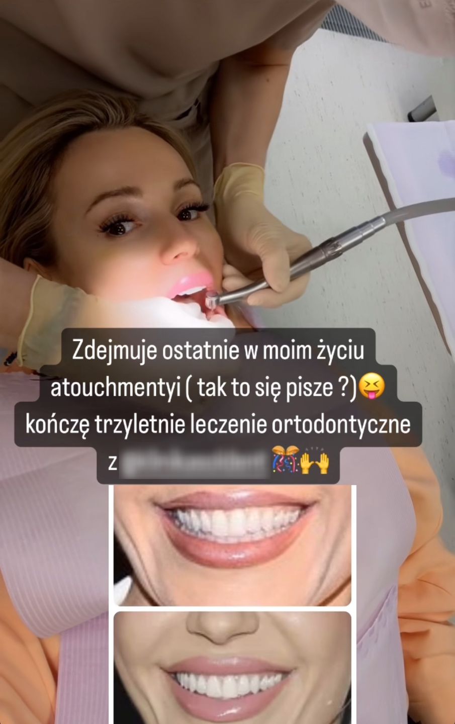 Doda pochwaliła się leczeniem zębów