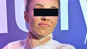 Producent "żelków na Hashimoto" Doroty R. przerwał milczenie. "Deklarujemy pełną gotowość"