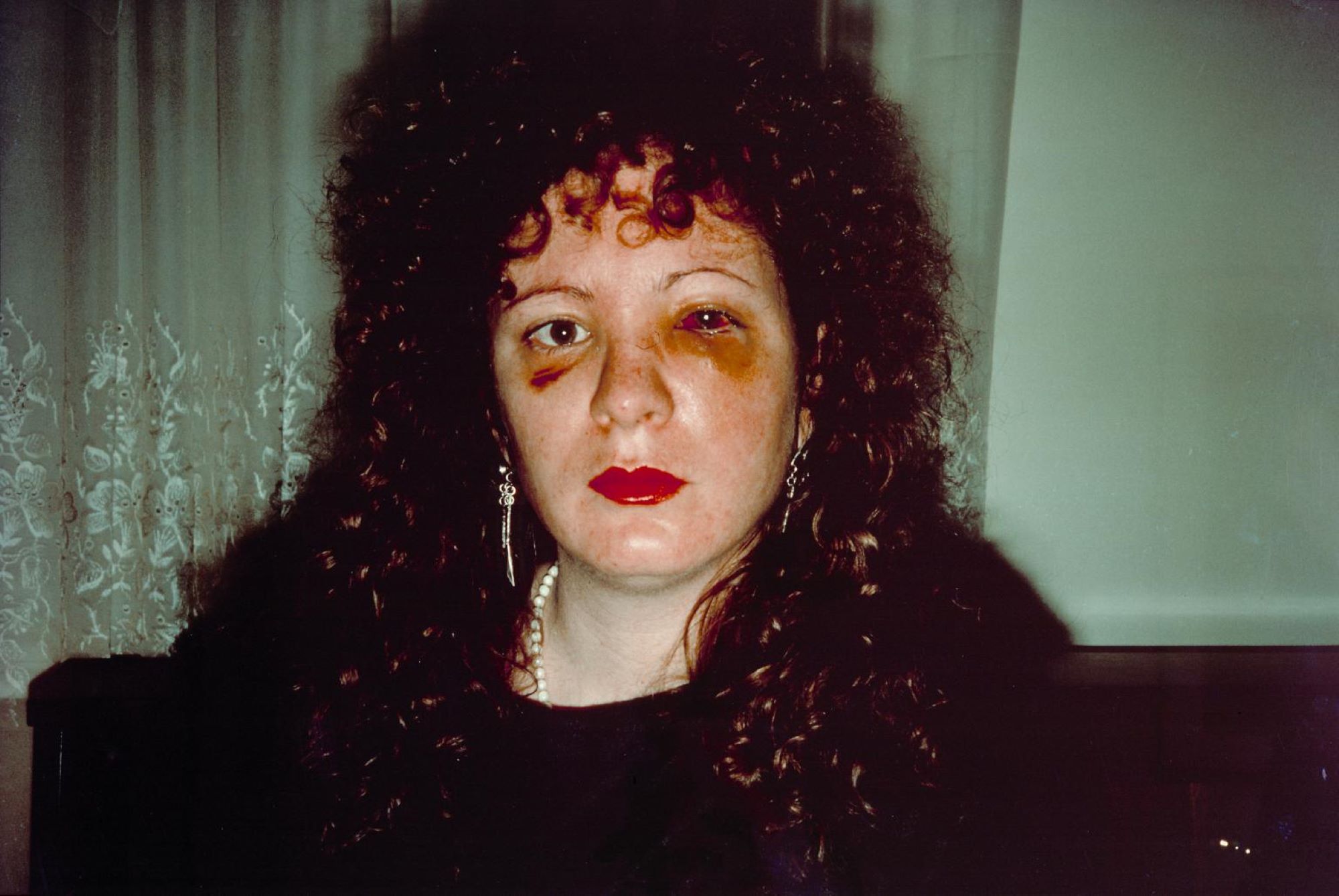 Autoportret ofiary przemocy domowej: Historia zdjęcia Nan Goldin 1