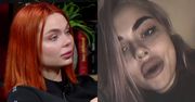 Zapłakana Luxuria o powiększonych wargach: "Jak byłam mała, to skleiłam sobie usta kropelką"