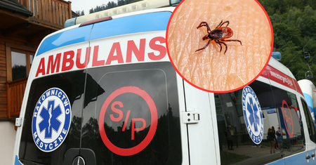 Ponad 800 przypadków tylko na Śląsku. Sanepid ostrzega przed chorobą