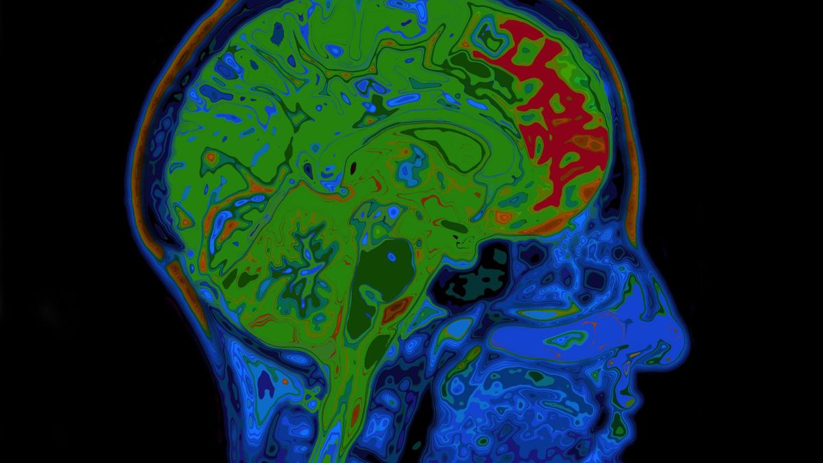 Zdjecie mózgu / 123RF