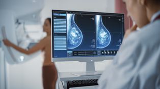 Zaproszenie na mammografię dla mieszkanek powiatu miechowskiego
