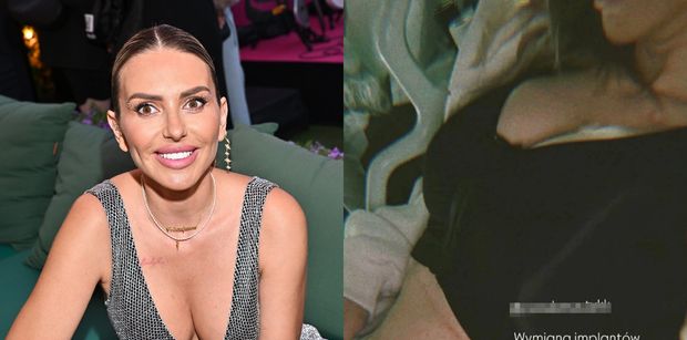 Monika Goździalska zafundowała sobie operację nosa i wymieniła implanty na większe. "Grawitacja nie czeka"