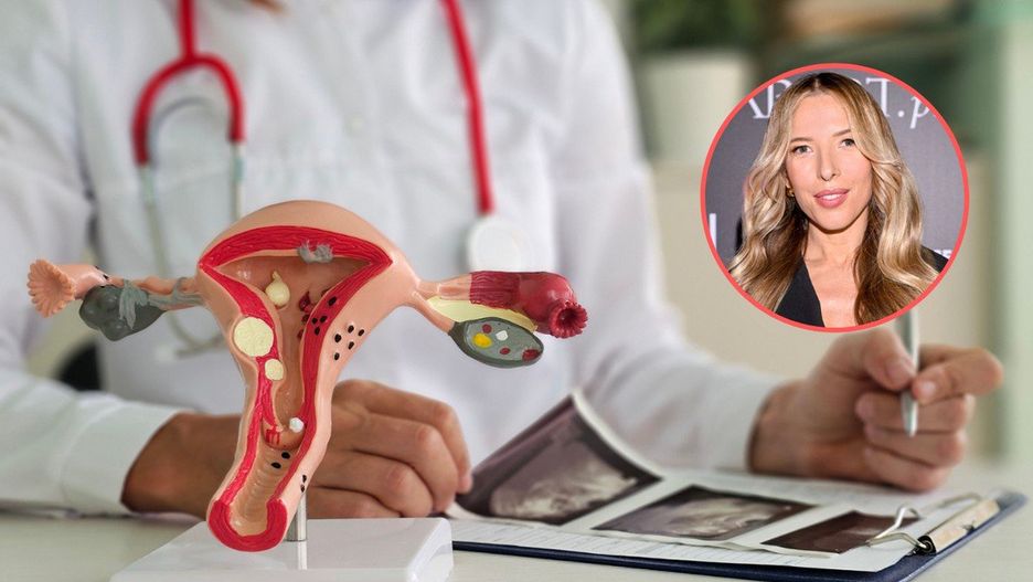 Środowisko lekarzy i związane z endometriozą jest wzburzone najnowszym projektem Ewy Chodakowskiej.