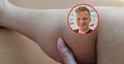 Tak unikniesz zakrzepicy w podróży. "Nie bagatelizuj tego problemu"