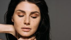 Jak pozbyć się piegów?