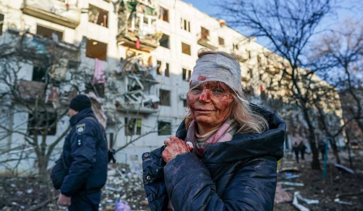 To jedno z najbardziej wstrząsających zdjęć wykonanych w pierwszych dniach wojny. Czuhujew, 24 lutego 2022 roku