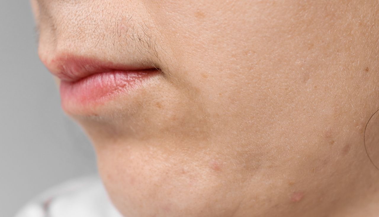 Unmasking the truth behind women's mustache: Causes and effective solutions