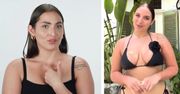 Przyszła na casting "Top Model". NIE DO WIARY, co usłyszała od lekarza