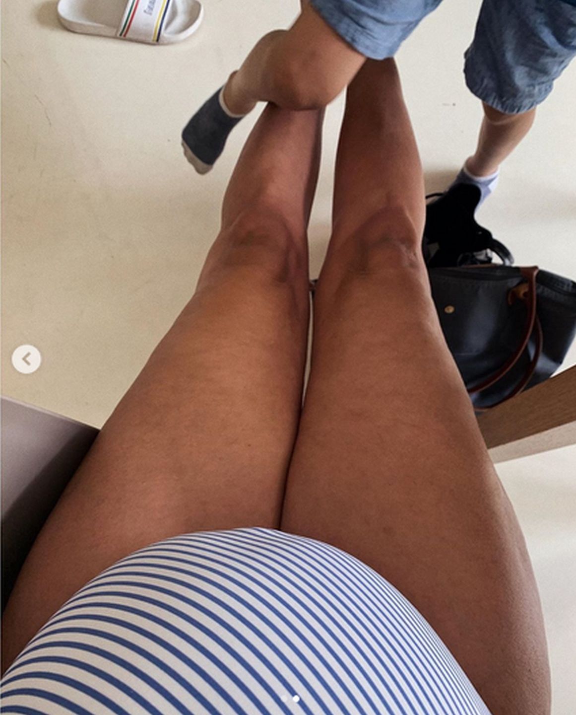 Aleksandra Żebrowska pokazuje cellulit