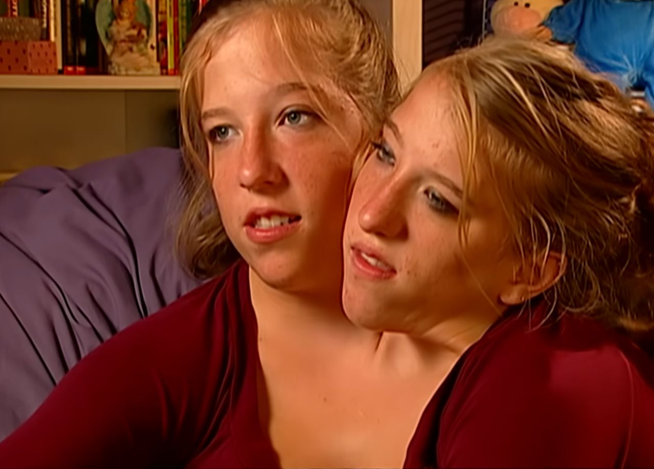 Conjoined twins Abby and Brittany Hensel navigate love and work