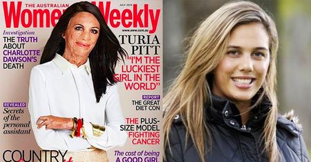 Ofiara pożaru na okładce magazynu dla kobiet! (FOTO)