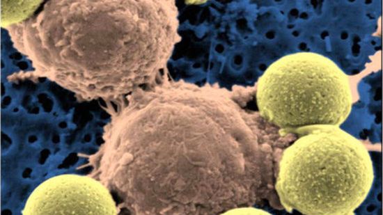 Leczenie raka... wirusem HIV – to działa! 1