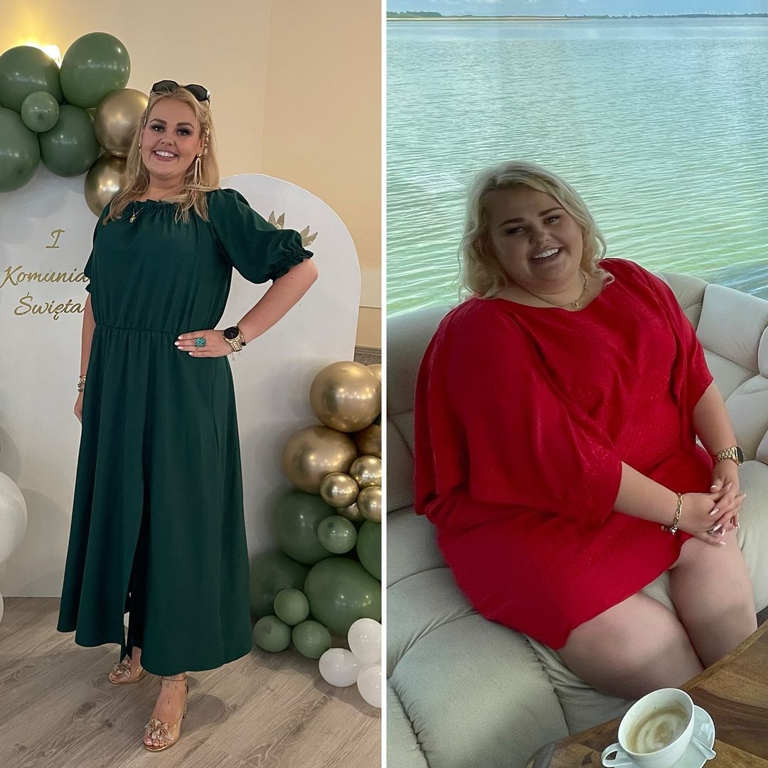 Kinga Zawodnik pokazała, jak wygląda po zmniejszeniu żołądka
