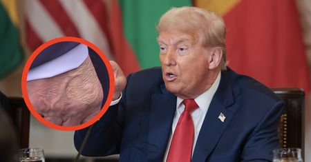 Dłoń Donalda Trumpa. Uwagę przyciągnął tajemniczy ślad