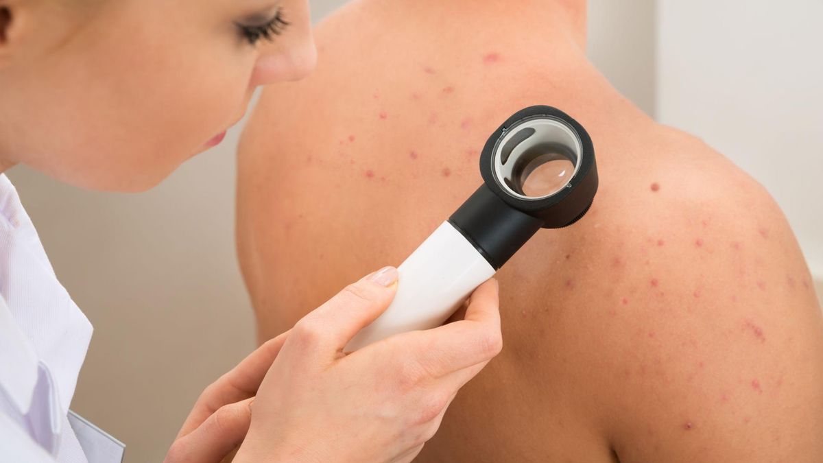 Plamica Schönleina-Henocha – charakterystyka, przyczyny, objawy, diagnoza i leczenie