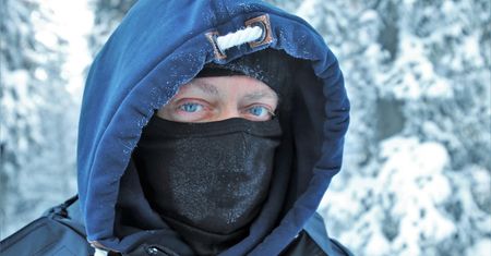 Uczulenie na zimno. Mogą pojawić się bąble, obrzęk, zaczerwienienie